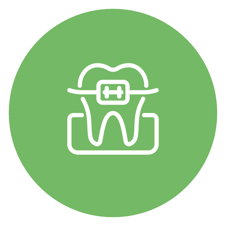Braces or Aligners Placement