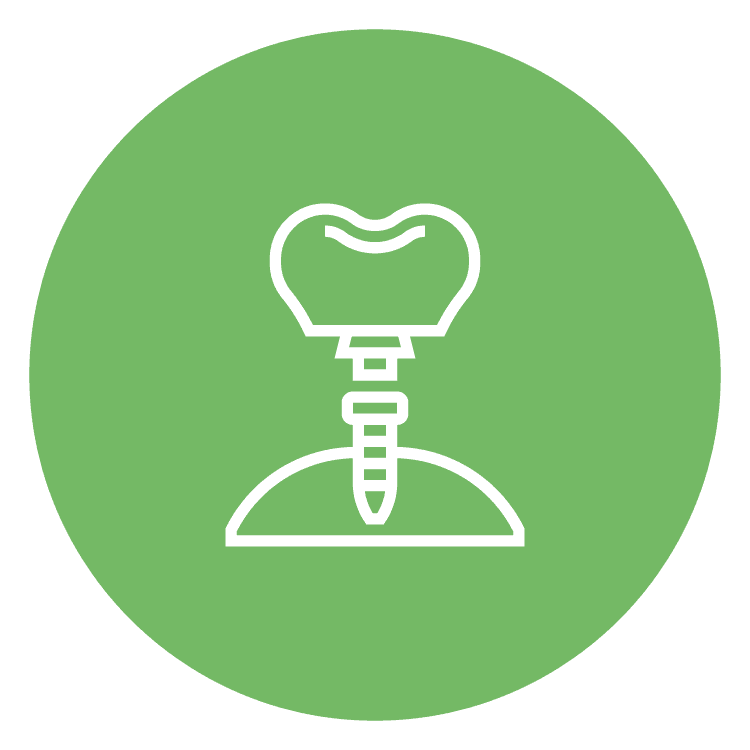 Abutment Placement