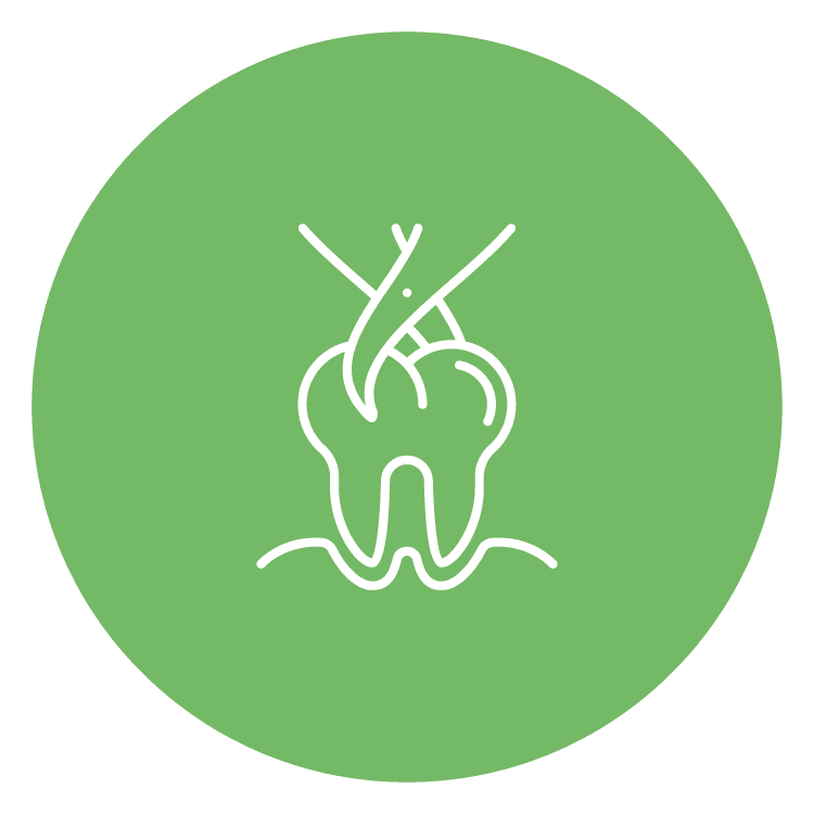 Tooth Removal & Implant Placement