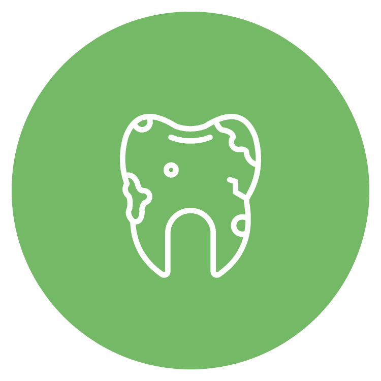 Prevents Further Tooth Decay